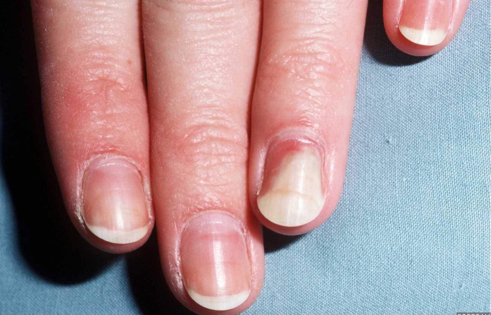 Как избежать болезней ногтей на руках: советы и фото