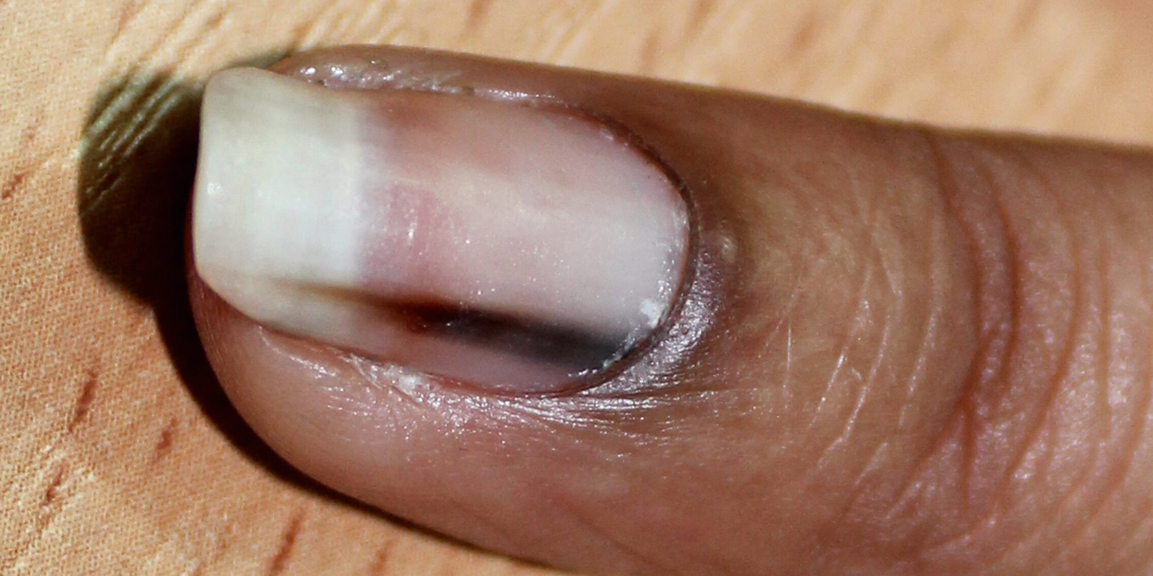 Популярные болезни ногтей на руках: скачать бесплатно фото